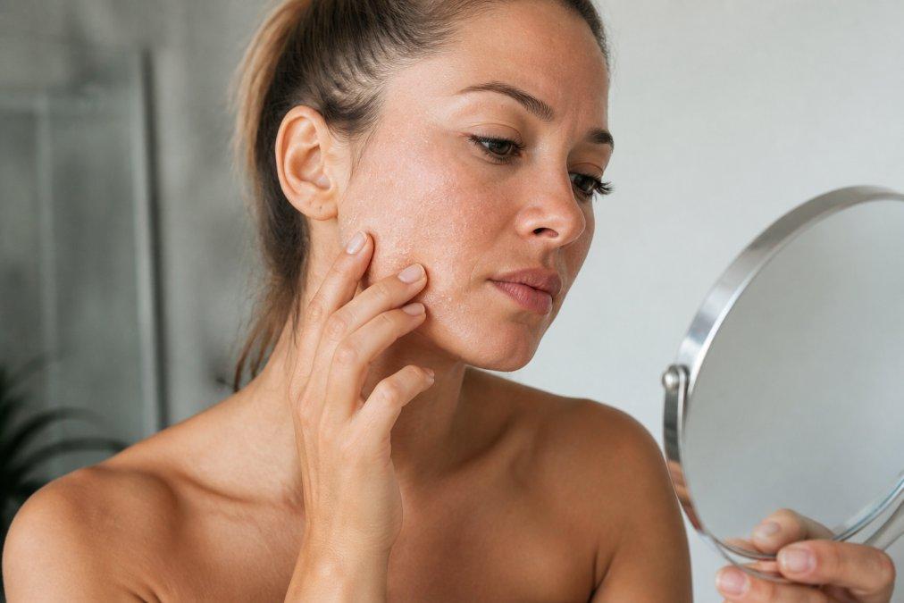 Tipps gegen trockene Haut nach Solarium